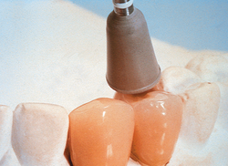 Ceramiste HP (Shofu)