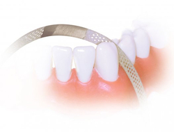 NTI Diamond Finishing Strips, 10/Pkg