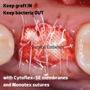 Cytoflex SE ePTFE Textured Membrane (Surgical Esthetics)