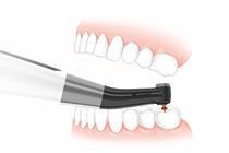 Beyes ApexPilot G3 Endo Motor with Built-in Apex Locator 