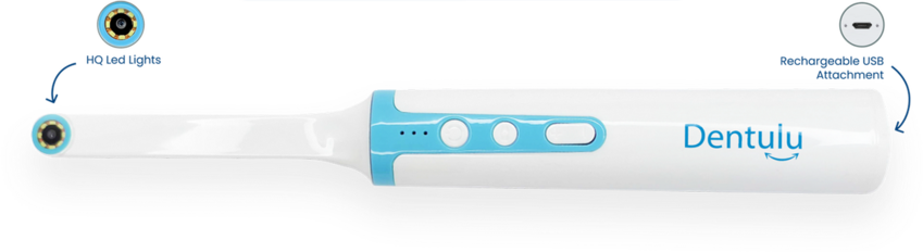 Mouth CAM At Home (Dentulu)