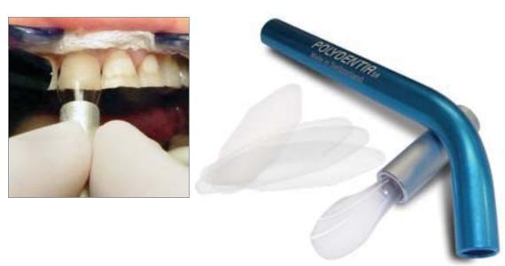 Cervical Former (Polydentia)