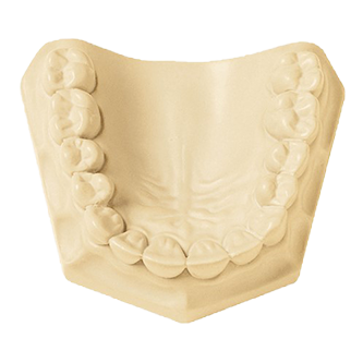 Resinrock Xl5 (WHipmix)